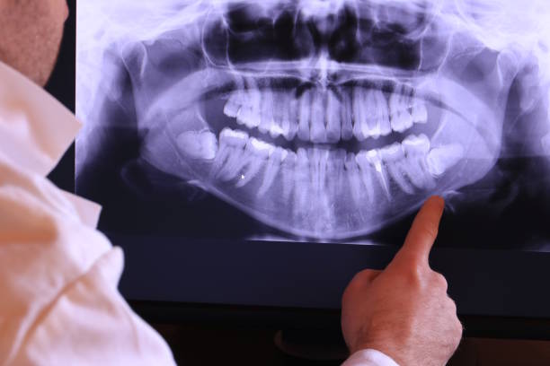 Best Pediatric Emergency Dentist in Syracuse, KS