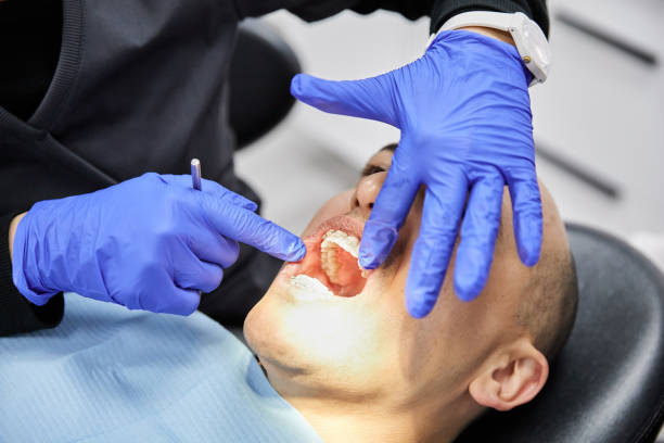 Best Emergency Wisdom Teeth Removal in Syracuse, KS