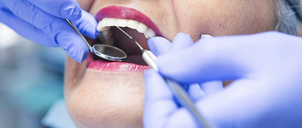 Best Emergency Root Canal Treatment in Syracuse, KS